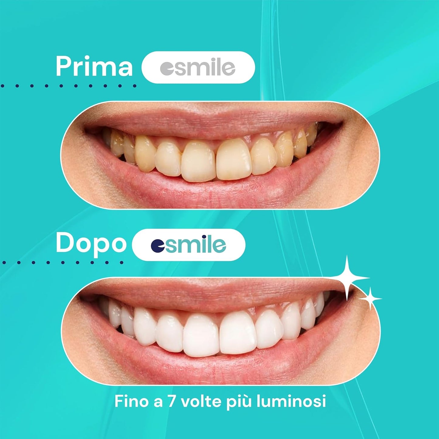 ESMILE Mint Dental Whitening Strip - 14 Teeth Whitening Strips | Peroxide Free Dental Whitening Gel | Dental Whitening Patch - White Teeth in 7 Days