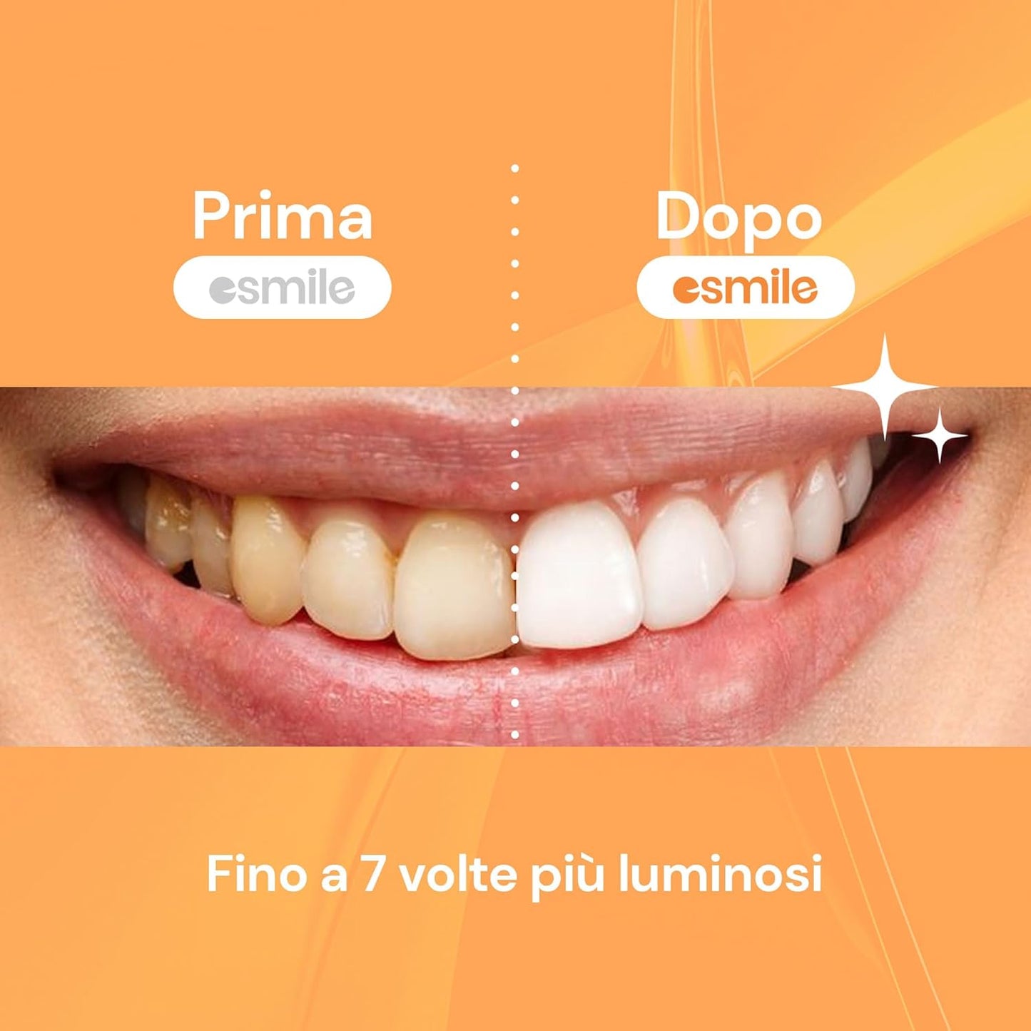 Dental Whitening Strips / Pack of 14 Mango Flavored Teeth Whitening Strips - Esmile