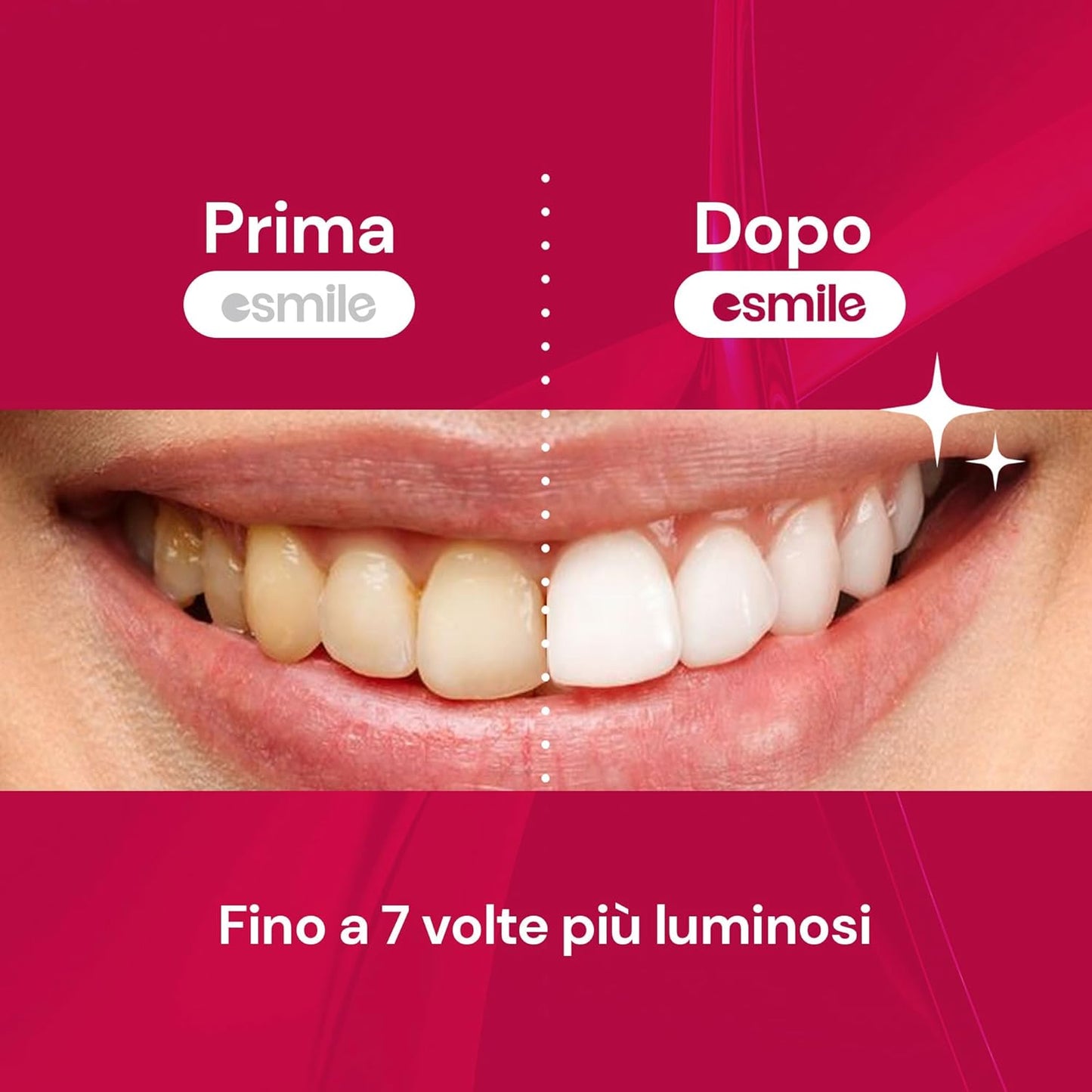 Dental Whitening Strips / Pack of 14 Red Velvet Flavored Teeth Whitening Strips - Esmile