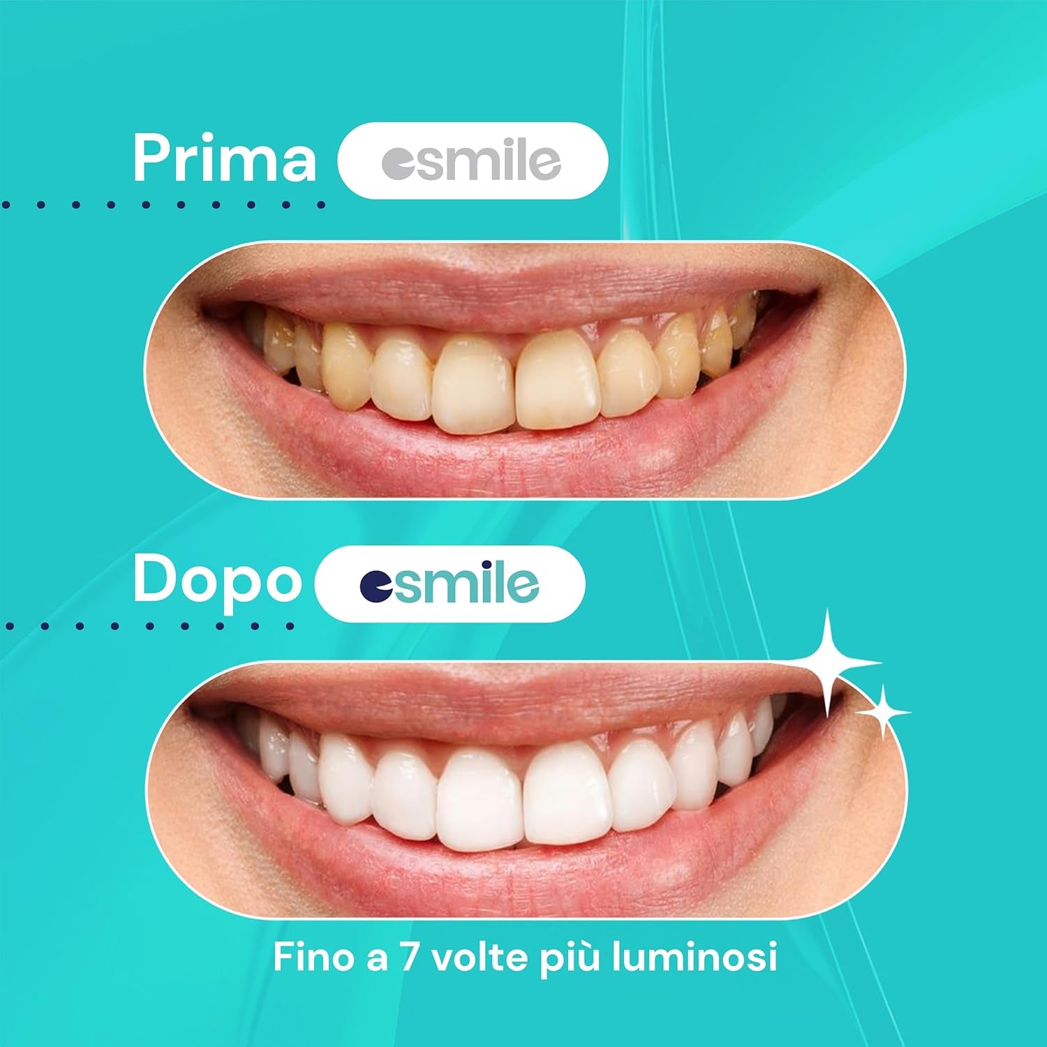 ESMILE Mint Dental Whitening Strip - 14 Teeth Whitening Strips | Peroxide Free Dental Whitening Gel | Dental Whitening Patch - White Teeth in 7 Days
